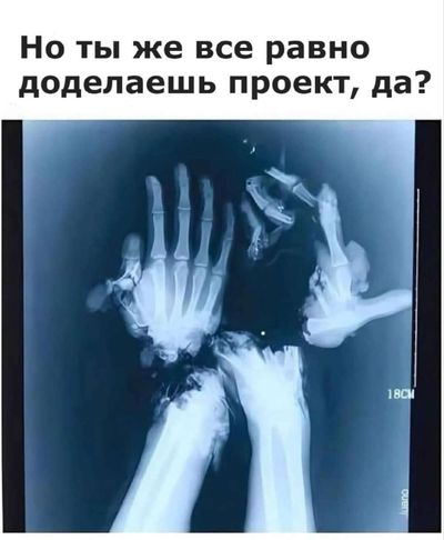 Post media