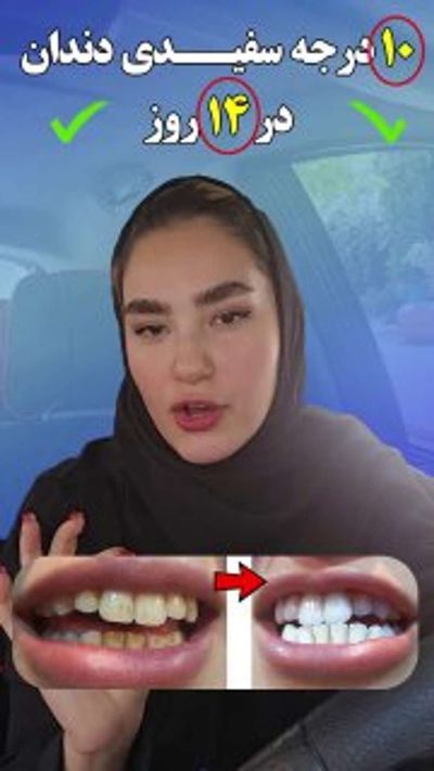 Post media