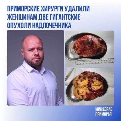 Post media